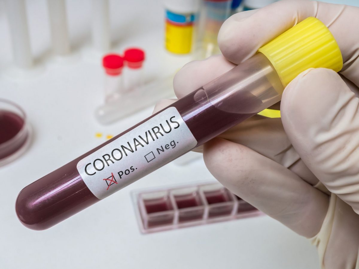 8-maya-olan-koronavirus-statistikamiz