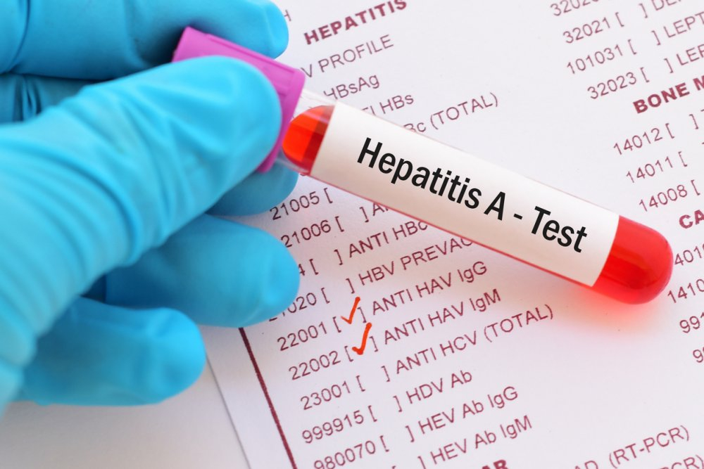 hepatit-a-bu-yasdaki-insanlara-daha-tez-yoluxur
