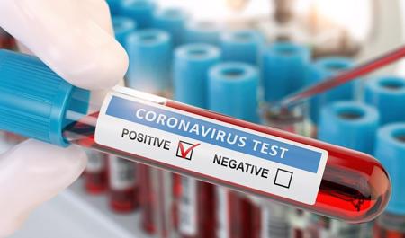 12-iyuna-olan-koronavirus-statistikasi