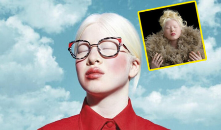 albinizmli-olduguna-gore-terk-edildi-indi-dunya-taniyir