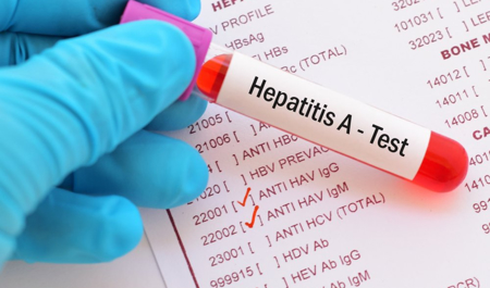 hepatit-a-virusuna-qarsi-vaksin-var