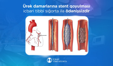 icbari-tibbi-sigortaya-bu-emeliyyat-da-daxil-edildi