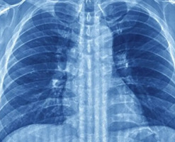 ah-cekmek-agciyerlerin-cokmesinin-qarsisini-alir