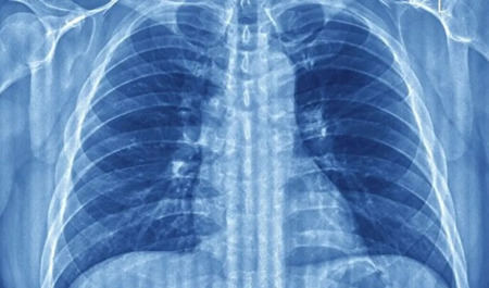 ah-cekmek-agciyerlerin-cokmesinin-qarsisini-alir