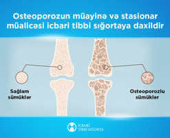 bu-sumuk-xesteliyinin-mualicesi-icbari-tibbi-sigortaya-daxil-edildi