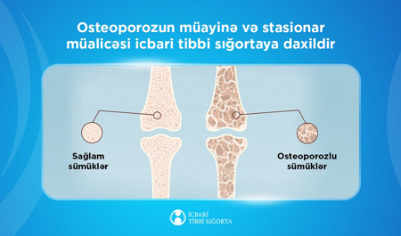 bu-sumuk-xesteliyinin-mualicesi-icbari-tibbi-sigortaya-daxil-edildi